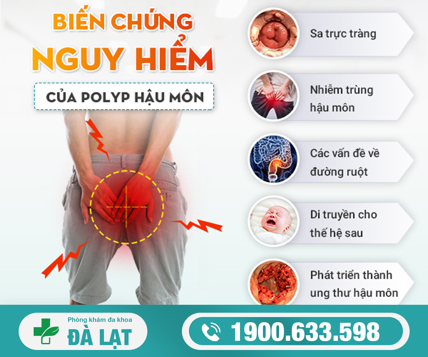 Hình ảnh minh họa